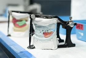 Dentures being manufactured