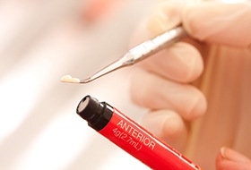 a tube of composite dental resin