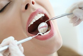 Closeup of smile during gum disease treatment
