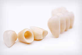 Ceramic dental crowns and bridges