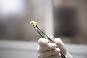 Extracted tooth