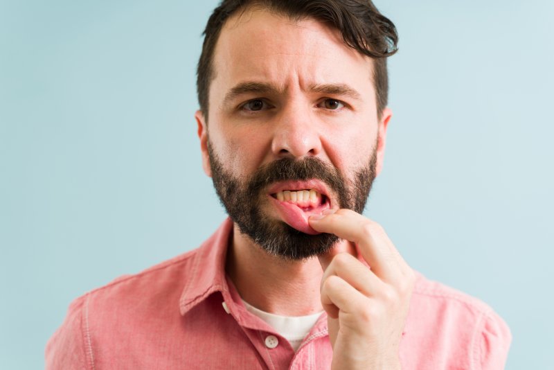 Man with gum disease