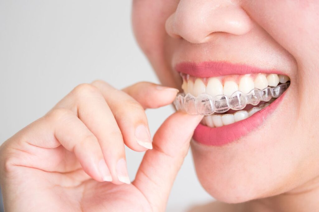 A woman putting on an Invisalign aligner